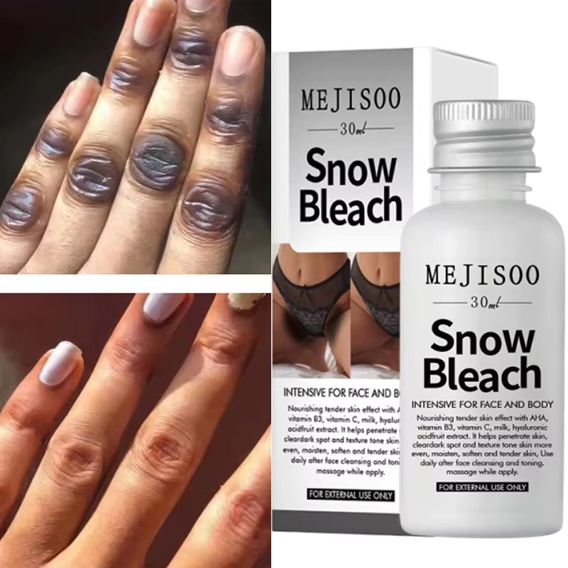 Fast Whitening Dark Knuckles B - đánh giá và giá Korean Lifestyle Products