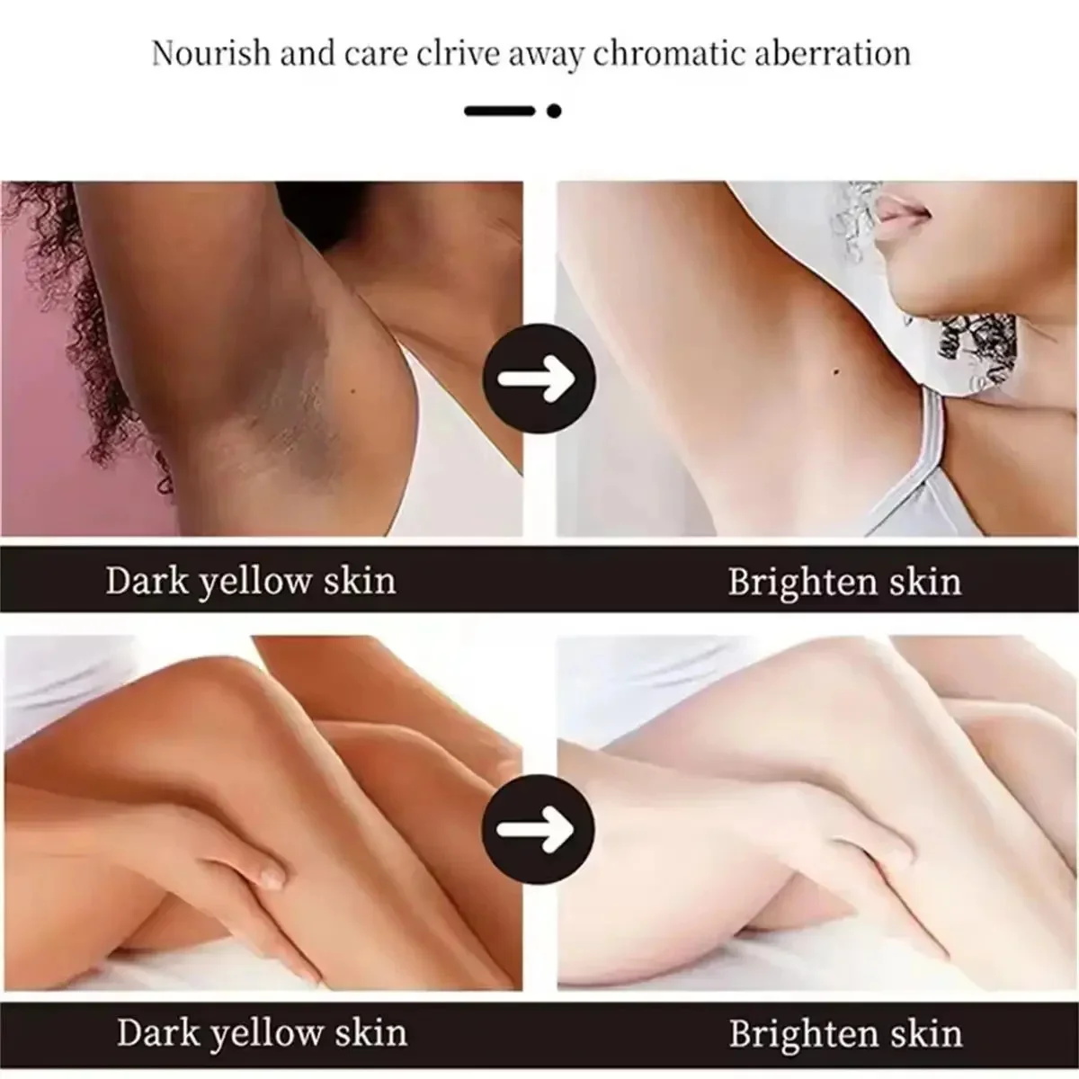 Fast Whitening Dark Knuckles B - đánh giá và giá Korean Lifestyle Products