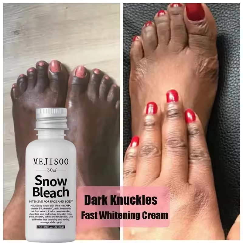 Fast Whitening Dark Knuckles B - đánh giá và giá Korean Lifestyle Products
