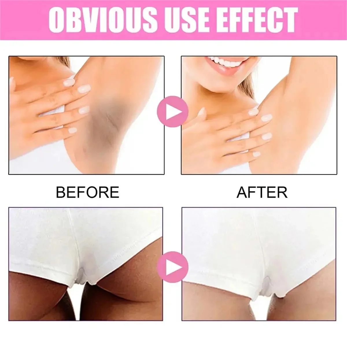 Fast Whitening Dark Knuckles B - đánh giá và giá Korean Lifestyle Products