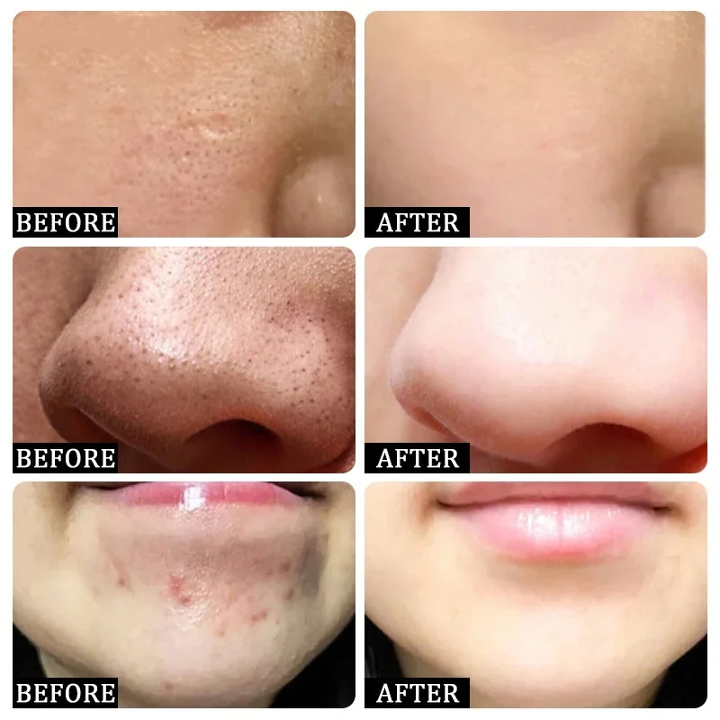 Salicylic Acid Pore Clearing C - đánh giá và giá Korean Lifestyle Products