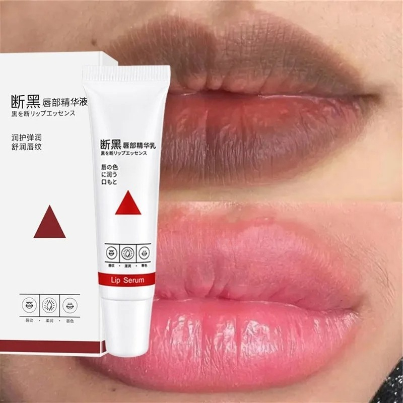 Remove Dark Lip Balm Fast Ligh - đánh giá và giá Korean Lifestyle Products