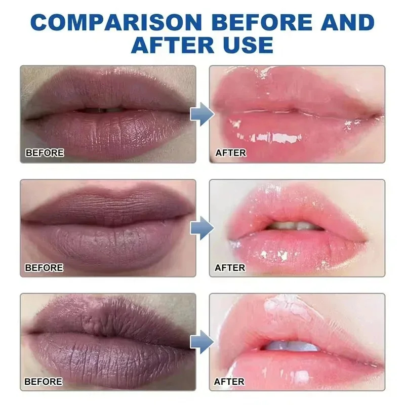 Remove Dark Lip Balm Fast Ligh - đánh giá và giá Korean Lifestyle Products