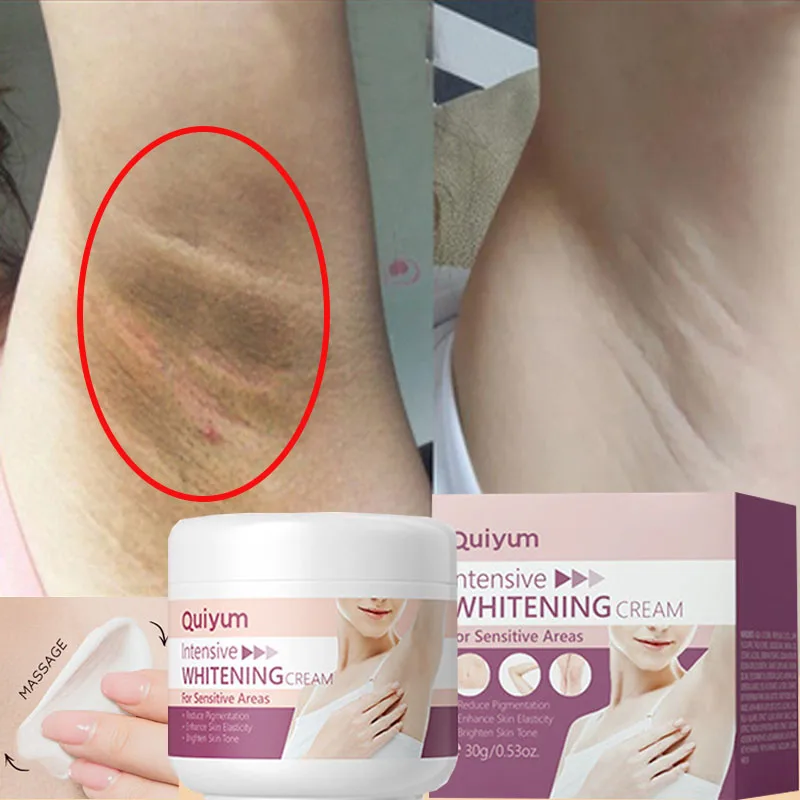Whitening Cream For Dark Skin  - đánh giá và giá Korean Lifestyle Products