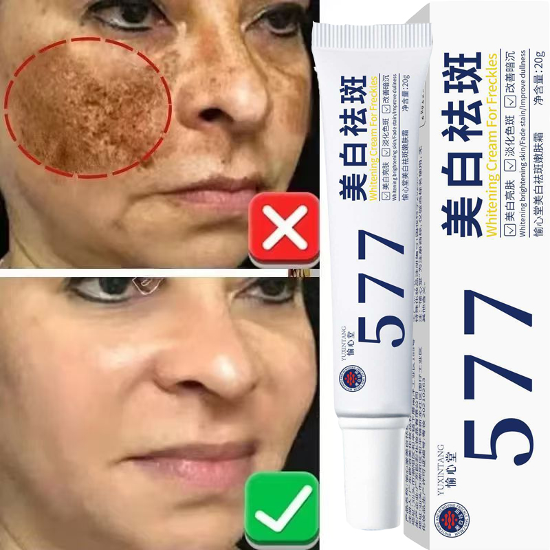 Whitening Freckle Cream Melasm - đánh giá và giá Korean Lifestyle Products