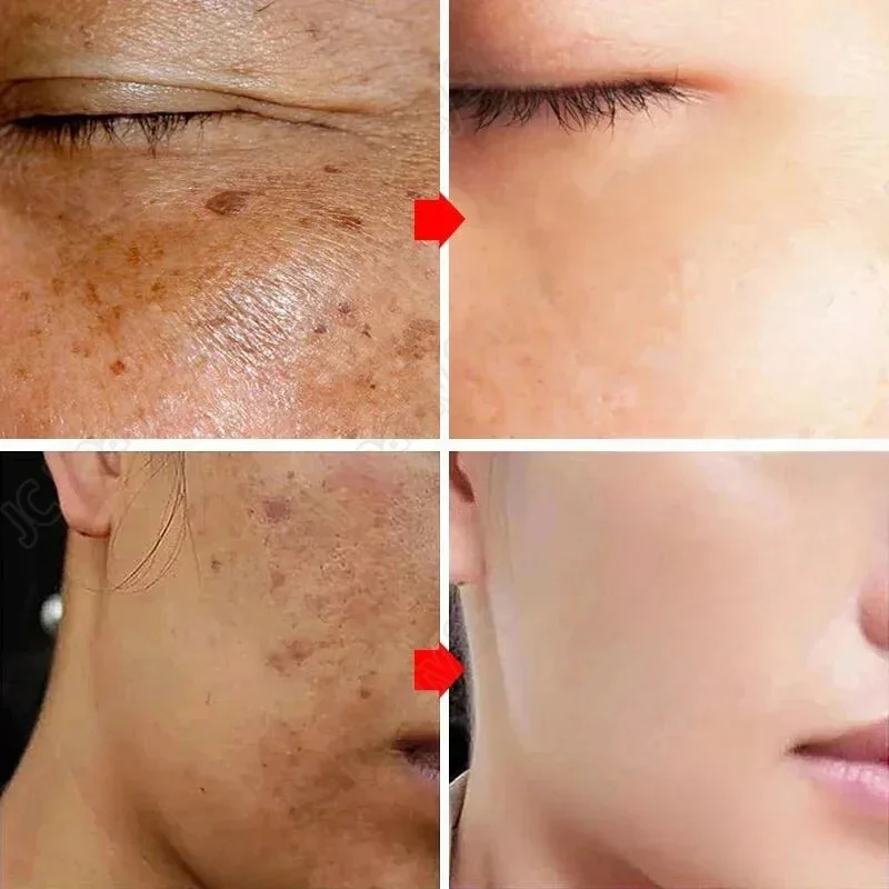 Whitening Freckle Cream Melasm - đánh giá và giá Korean Lifestyle Products
