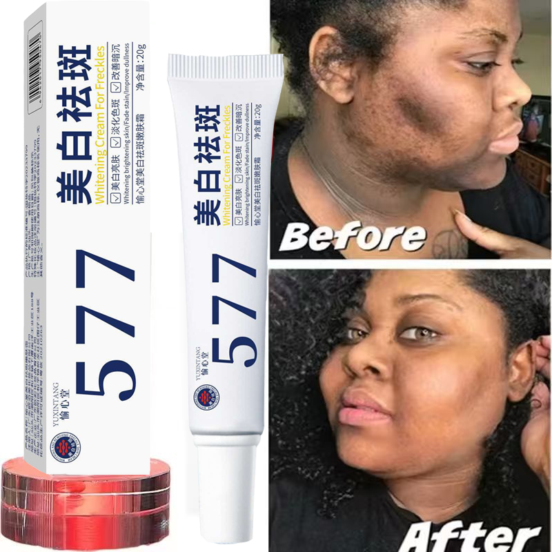 Whitening Freckle Cream Melasm - đánh giá và giá Korean Lifestyle Products