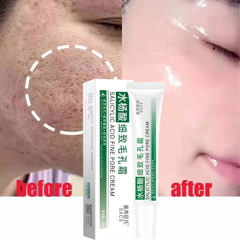 Salicylic Acid Pore Shrinking  - đánh giá và giá Korean Lifestyle Products