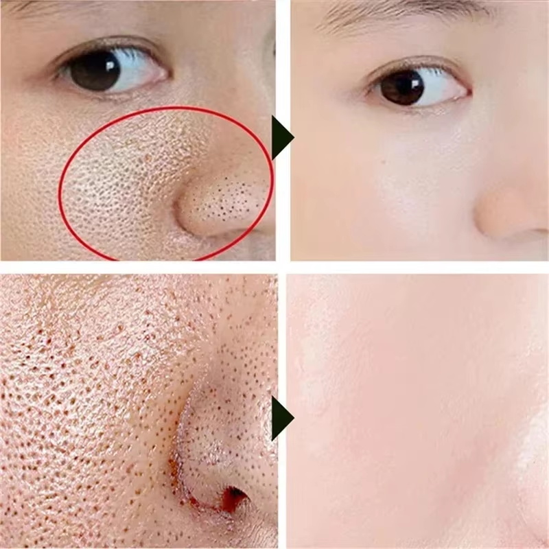 Salicylic Acid Pore Shrinking  - đánh giá và giá Korean Lifestyle Products